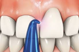 잇몸이 붓고 아플 때