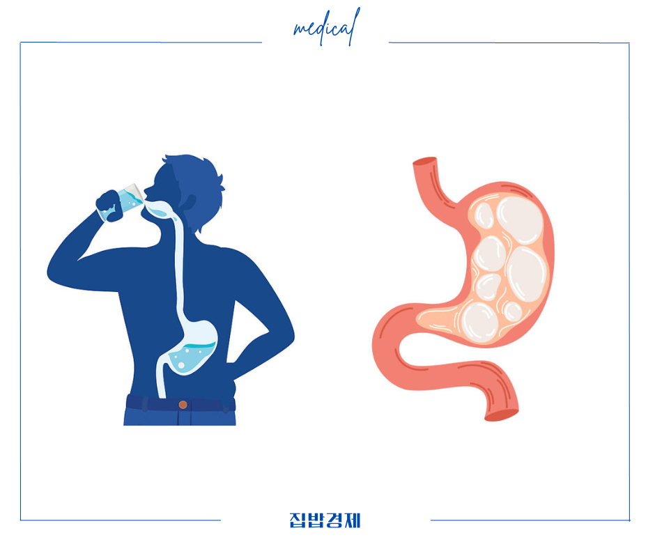 알룬정 부작용과 복약 정보