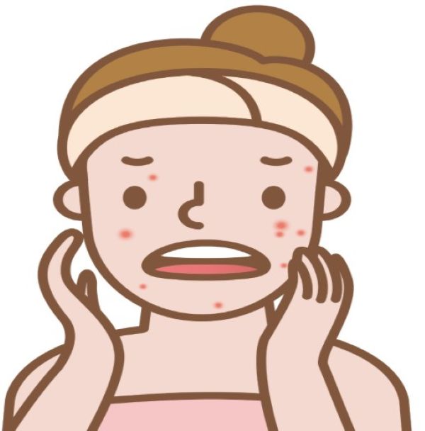 얼굴땀띠를 보고 당황스럼 여자아이