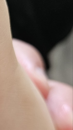 수족구병 증상 격리기간