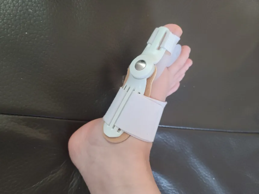 무지외반증 교정기