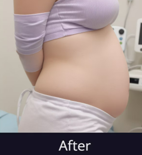 뱃살 빠짐 체형 변화