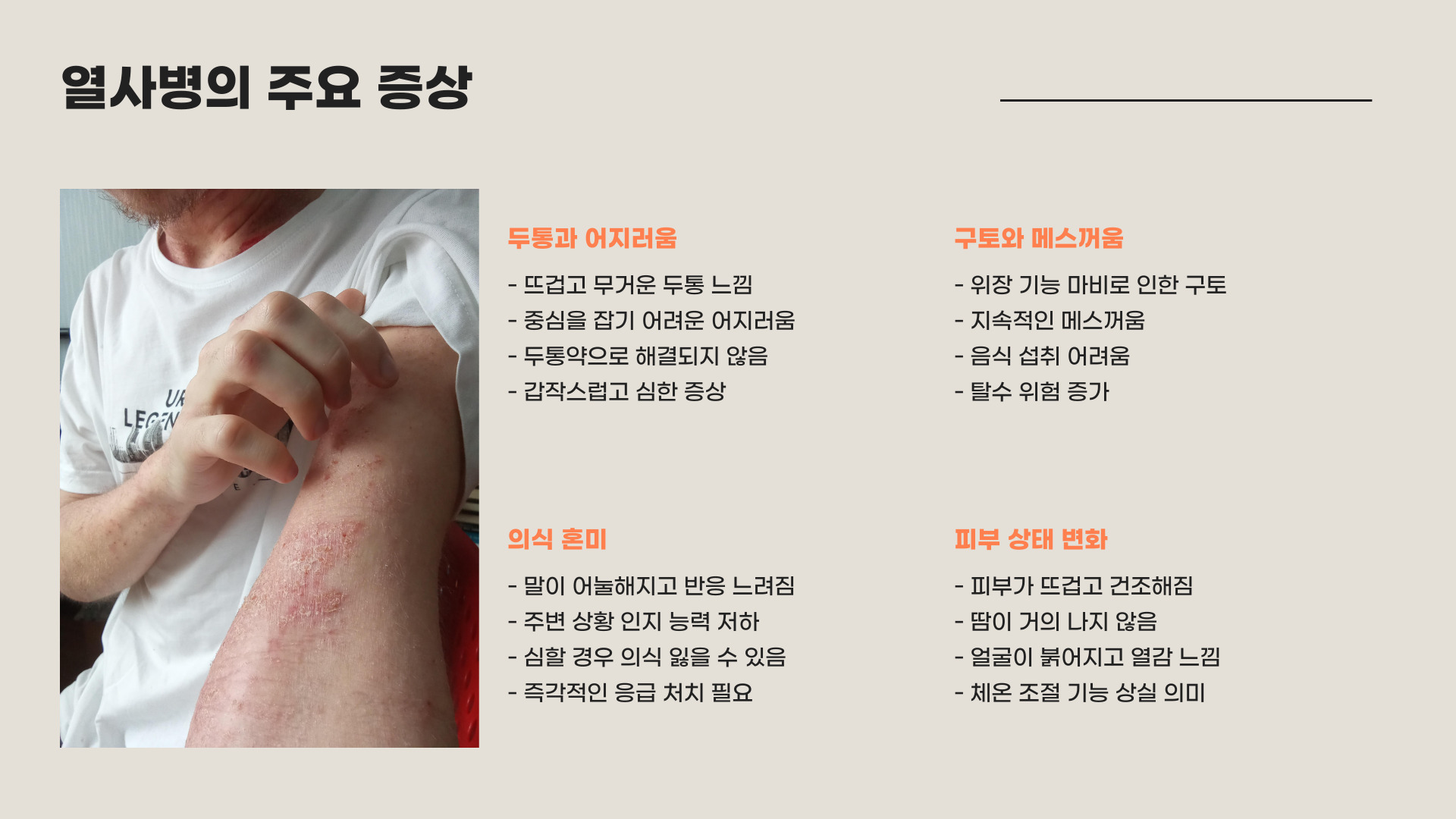 열사병 증상