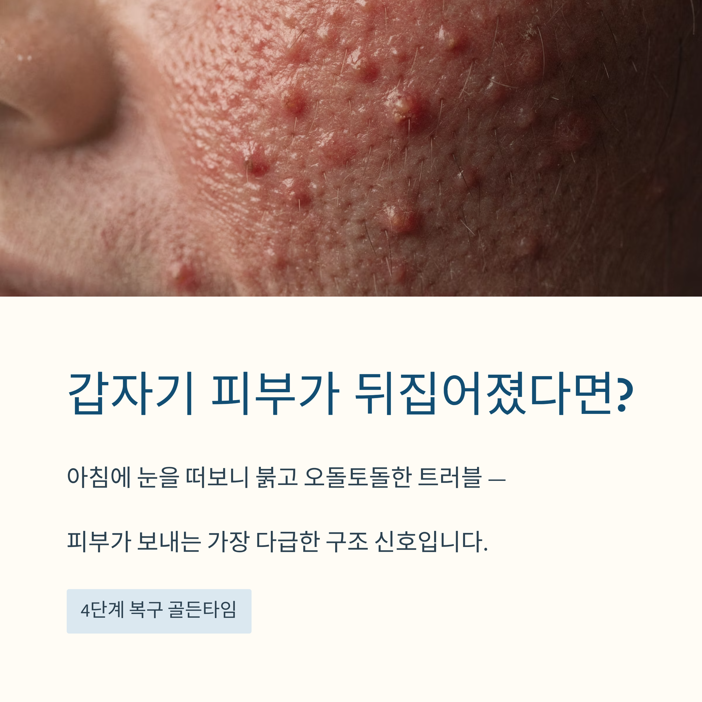 복구 골든타임