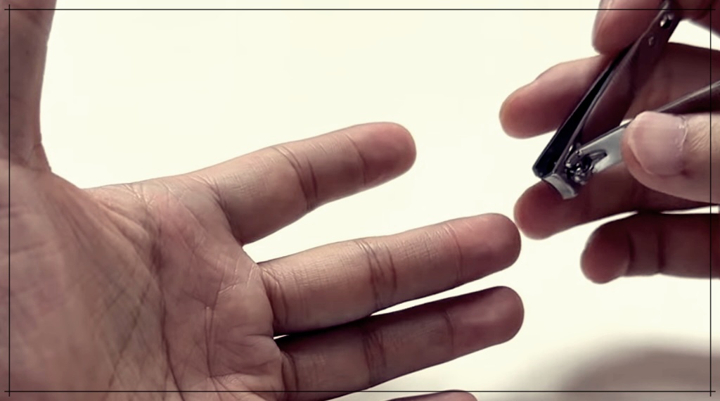 손가시빼는방법3가지