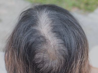 두피모발관리지도사 되는법 자격증 연봉 총정리