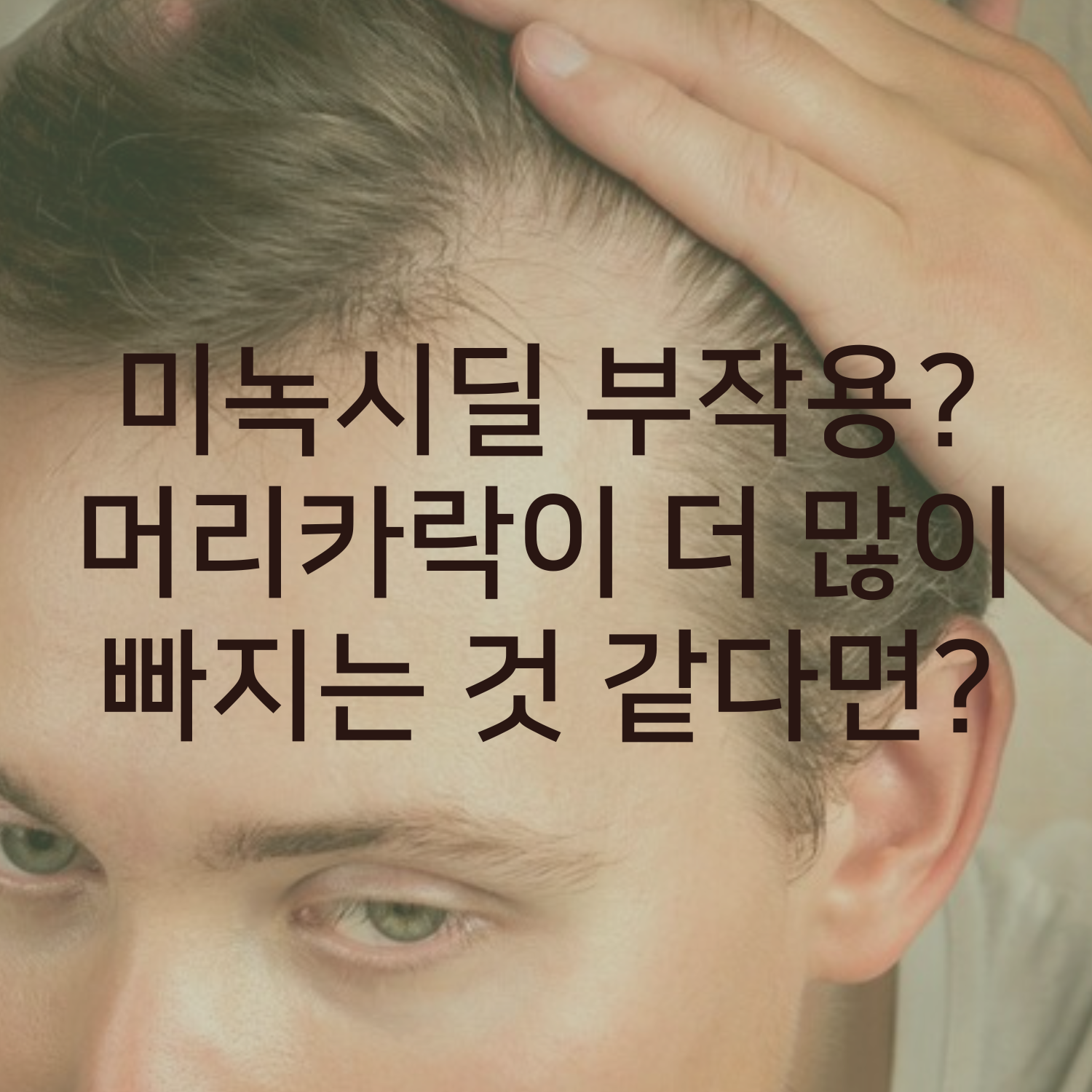 미녹시딜 사용 한달차 부작용, 사용 후에 머리카락이 더 많이 빠지는 것 같다면?