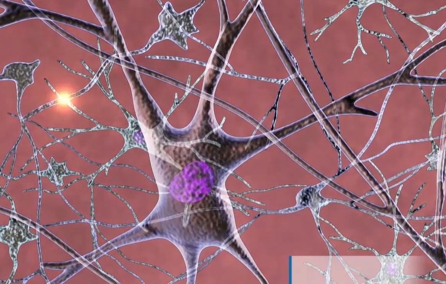 뇌경색 전조증상