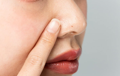 모공이 생겼다.