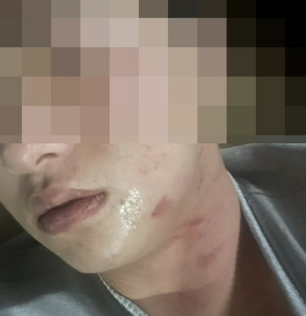 김하성 후배고소 임혜동 폭행