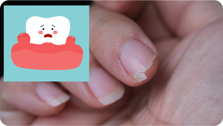 갱년기 시작 전 꼭 알아야할 골다공증 초기증상 5가지