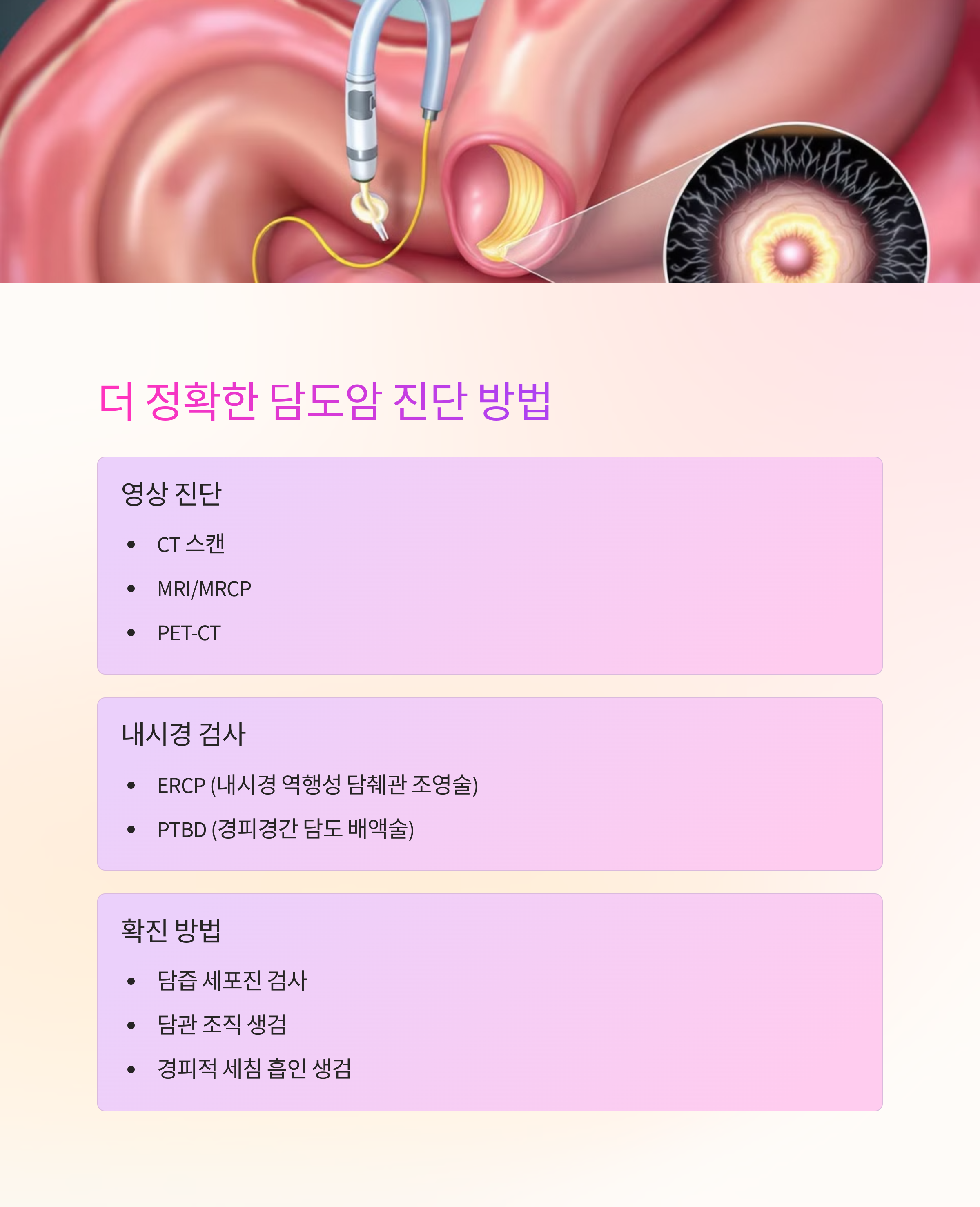 담도암 증상 초기단계 신호