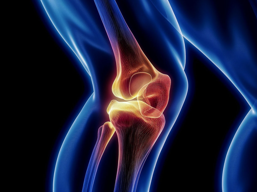 관절 및 뼈 건강 영양제 조합 – 칼슘, 비타민 D, MSM, 글루코사민