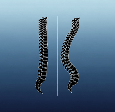 골다공증 증상과 예방법 총정리5