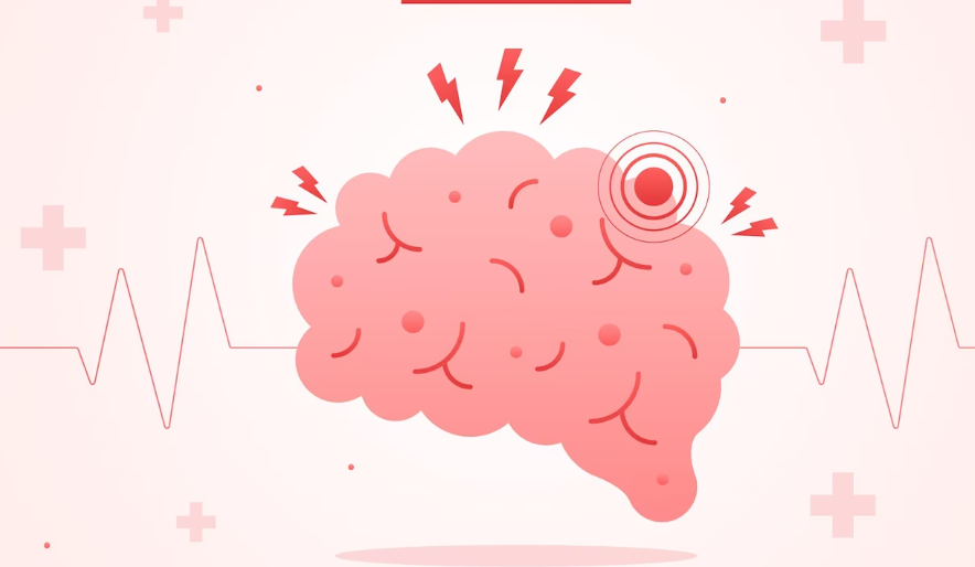 비정상적인 신경활동