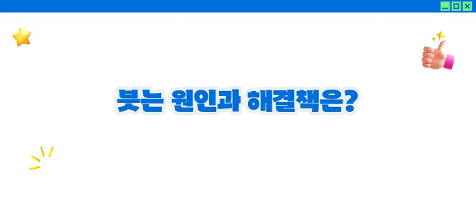 눈이 붓는 증상 원인과 대처법 (+자가진단)