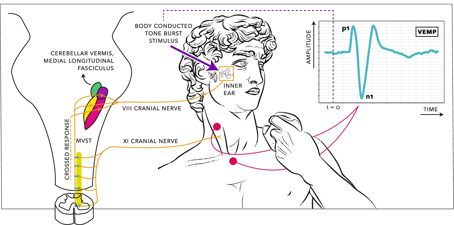Resonance Pattern
구조물 내부 반사·공진을 상자 형태로 묘사