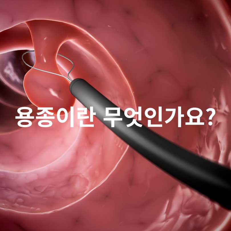 선종과 용종의 차이