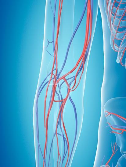 혈관 절제 및 재건