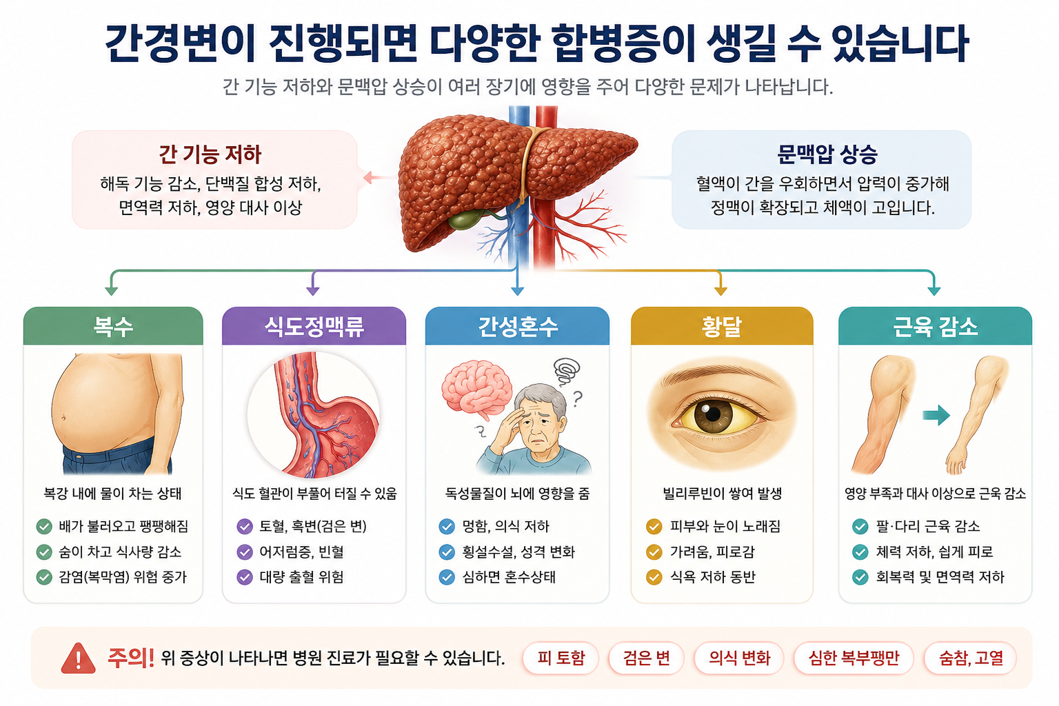 간경변 진행 시 복수, 식도정맥류, 간성혼수, 황달, 근육 감소 같은 대표 합병증이 어떻게 나타나는지 설명하는 의료 인포그래픽 이미지