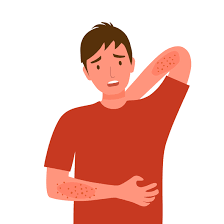 온몸이 가려운 증상