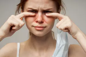 알레르기 비염 증상