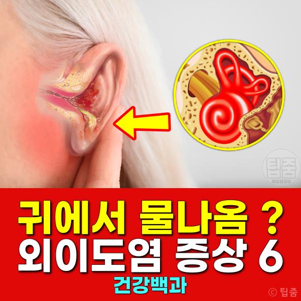 귀에서 물나옴 외이도염 증상
