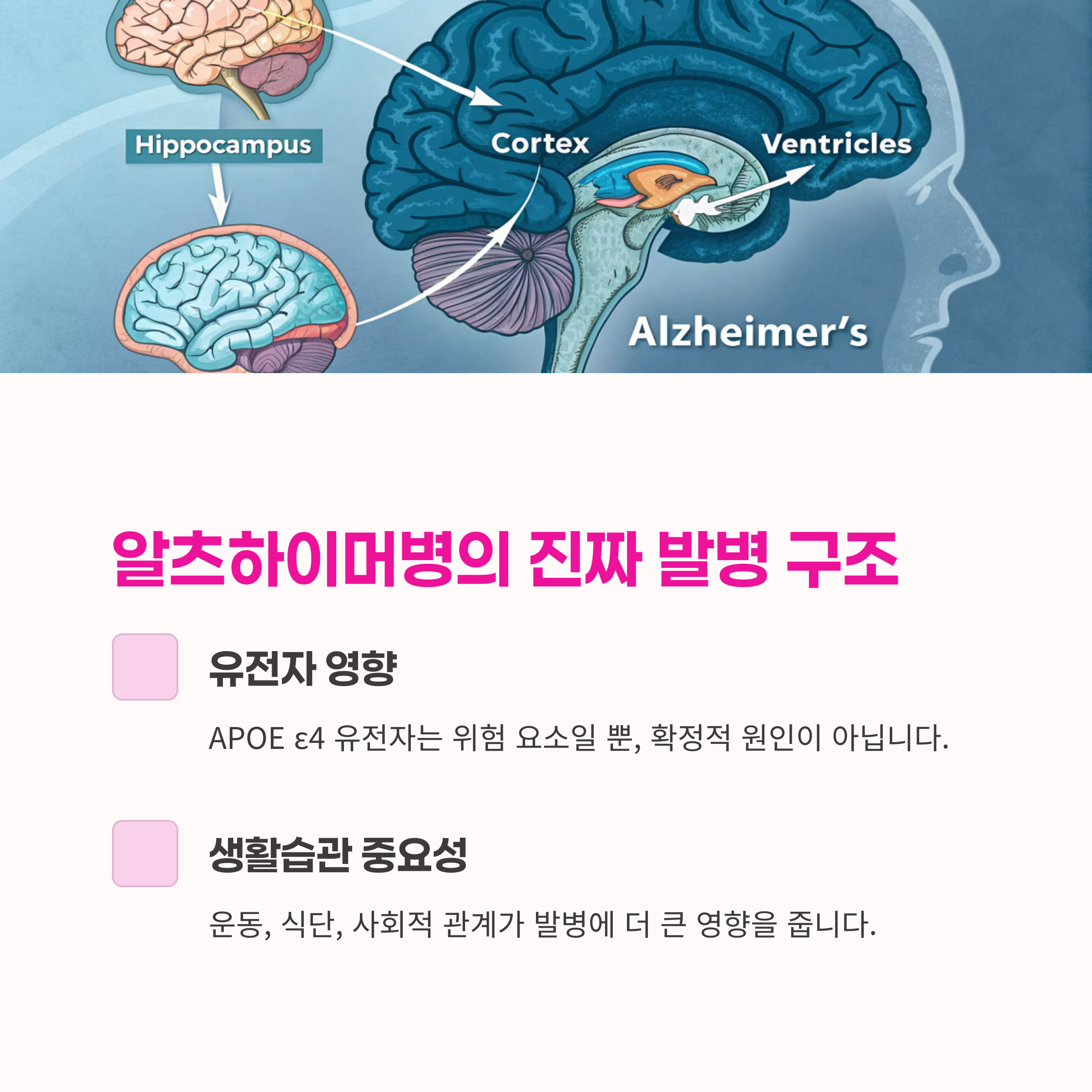 예방법,