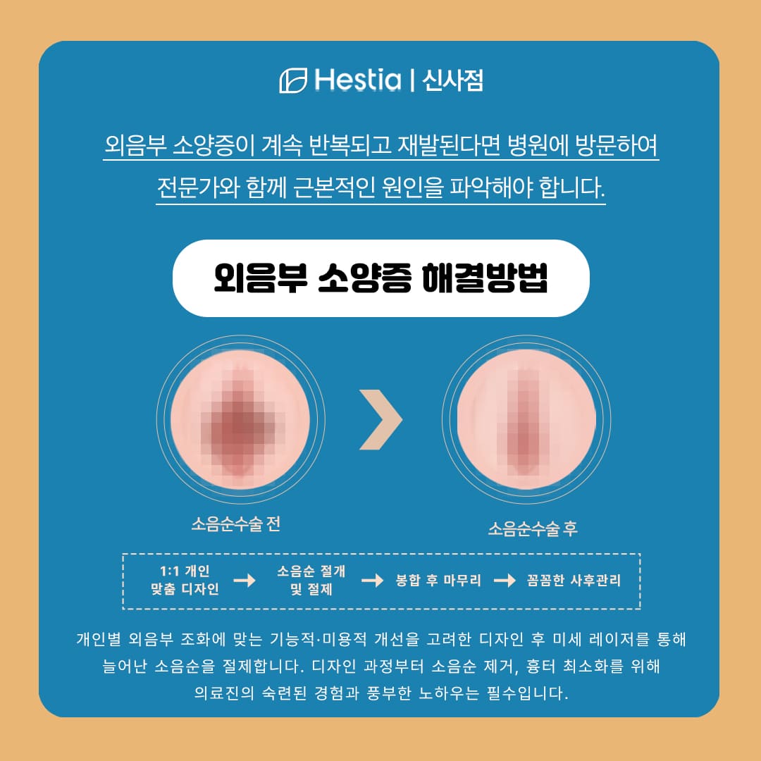 외음부 소양증 해결법은?