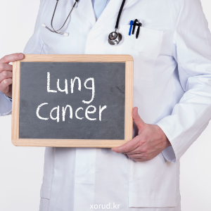 조기 발병 대장암