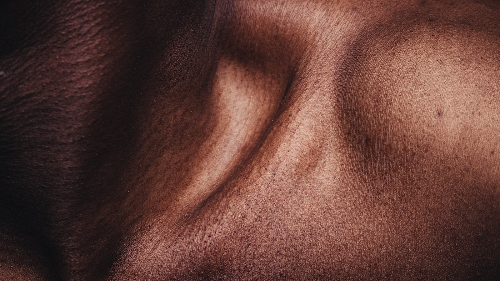 Skin Cancer in Men 1