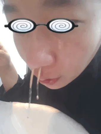 축농증 증상 치료방법 원인 으로_23