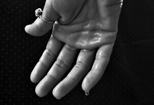 다한증으로 손에서 흐르는 땀