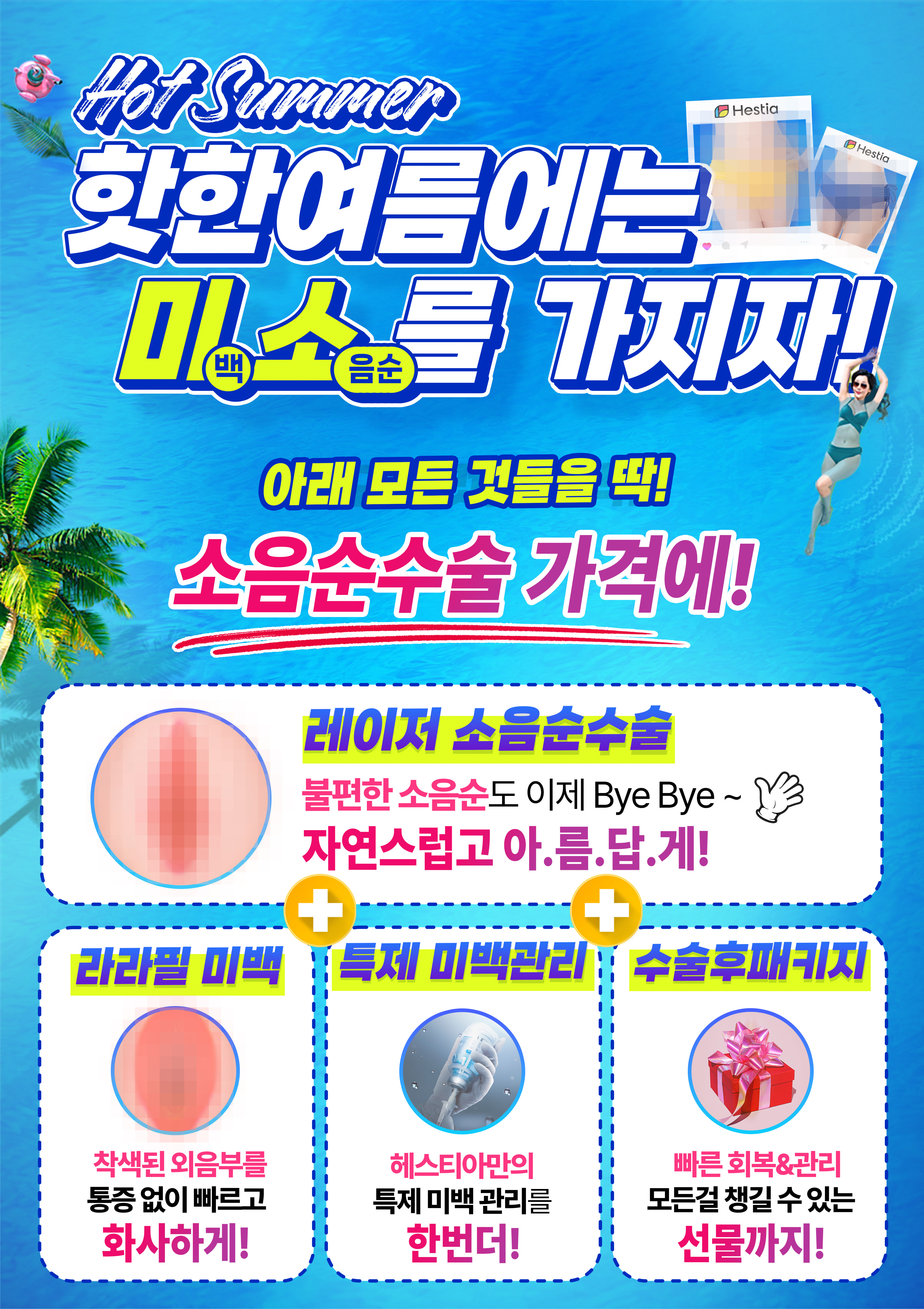 핫한 여름에는 미소를 가지자!
소음순수술 이벤트