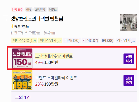 백내장 수술비용 사진