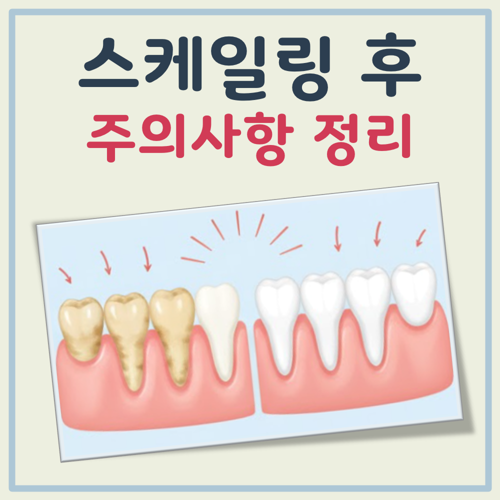 스케일링 후 주의사항 대표 이미지