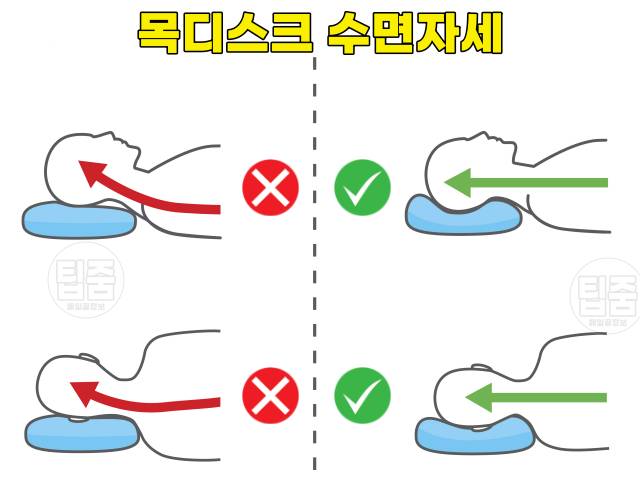 허리에 좋은 수면자세 나쁜자세 목디스크 허리디스크