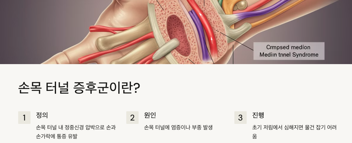 손목 터널 증후군이란?