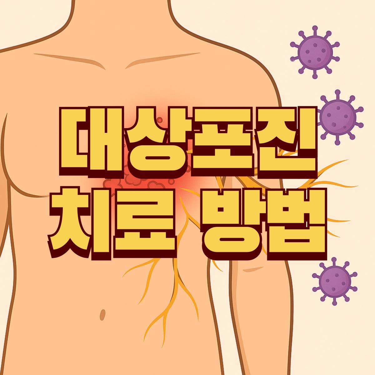 대상포진 치료 방법