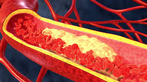 총콜레스테롤 정상수치