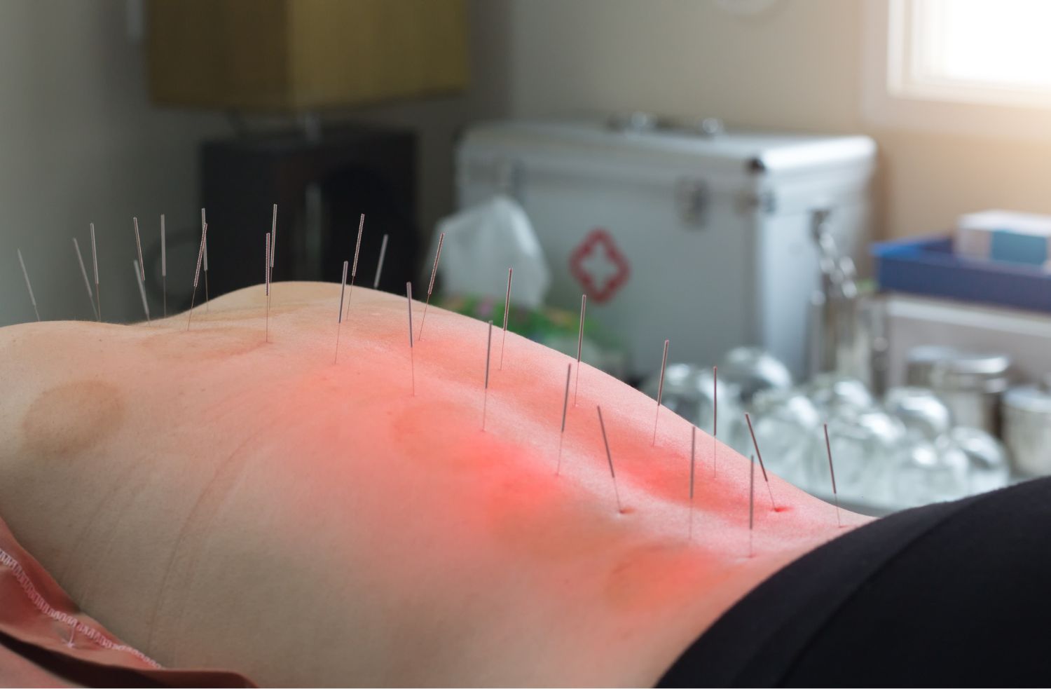 척추관 협착증 치료