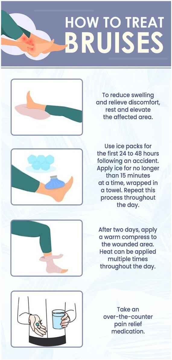 멍에 바르는 약 대체 요법