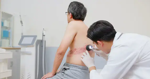거대세포바이러스질환 증상 치료방법 알아보기