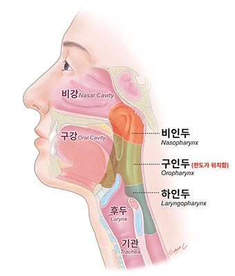 비인두암이란 증상 원인 증상 치료 재발