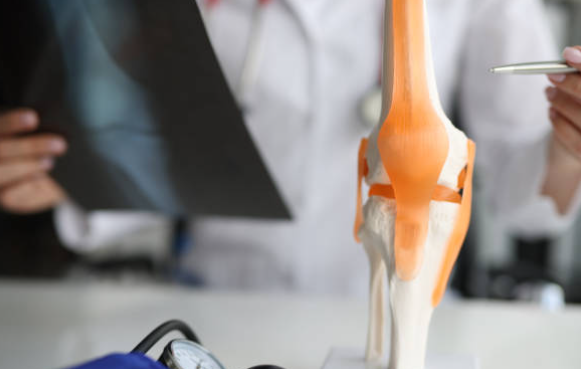 프로테오글리칸