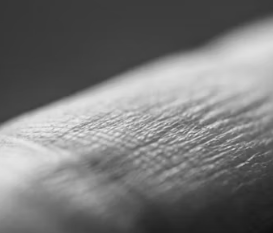 아토피 피부염 진단 기준 치료법 합병증