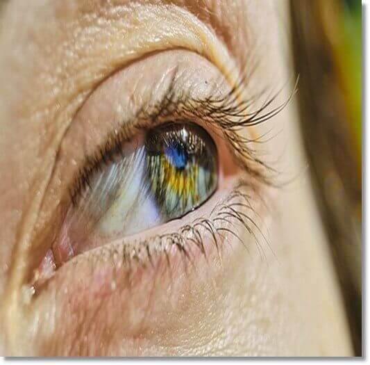 결막 모반 원인 및 증상, 예방 및 치료