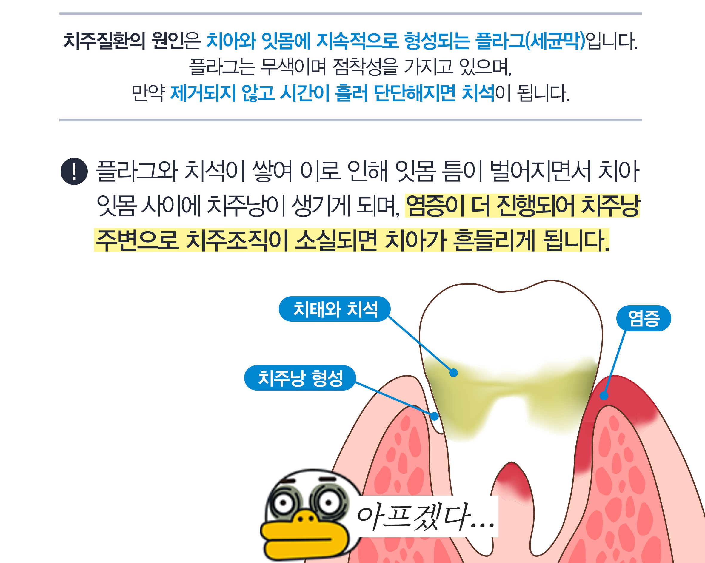 치주질환3
