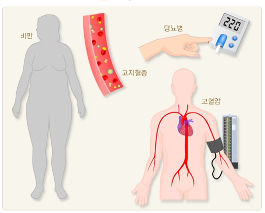 대사증후군 안내문