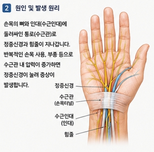 손목 골절